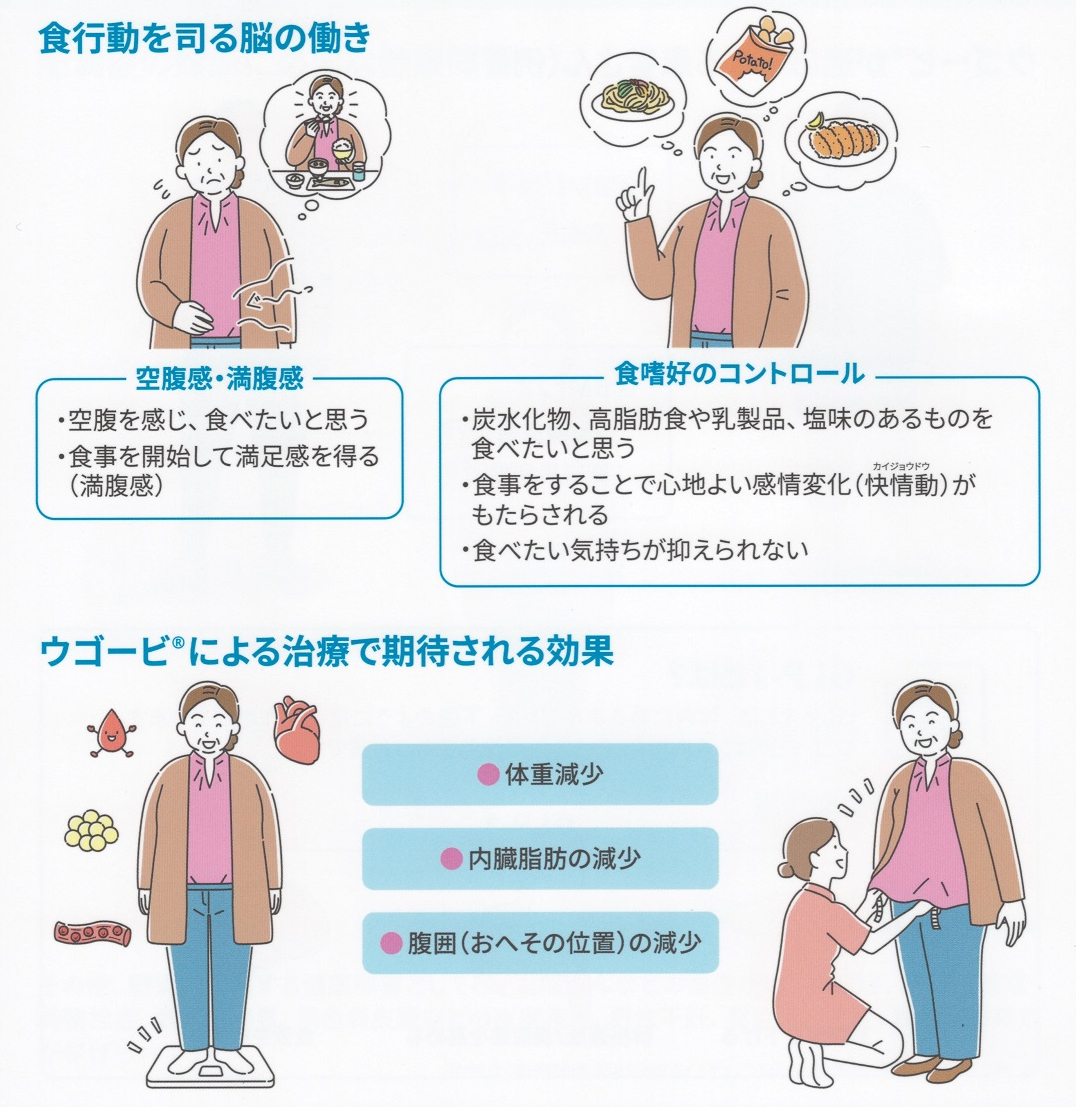 ウゴービの効果